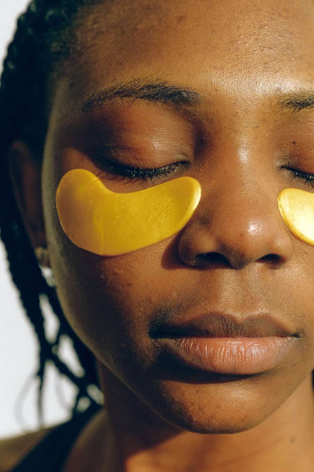 How to get rid of dark circles under eyes